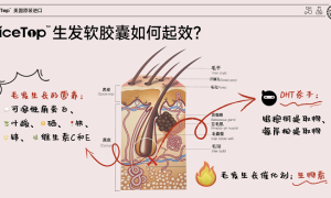 NiceTop所先养发胶囊双管齐下 从根源解决脱发难题